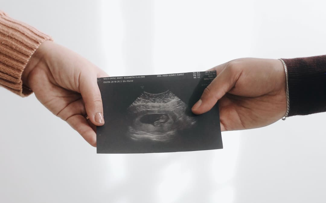 Ultrasound Timeline for Pregnancy