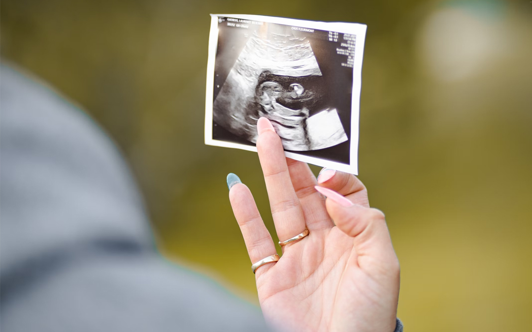 Ultrasound Before Abortion
